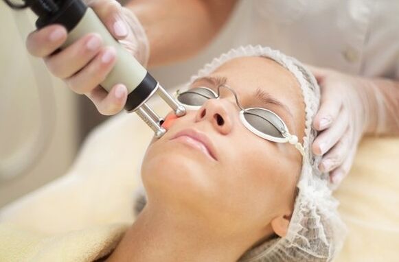 Heat exposure to epidermis