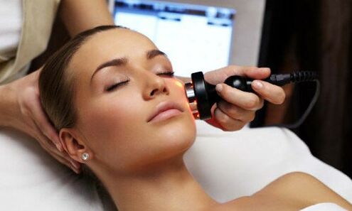 A facial laser rejuvenation